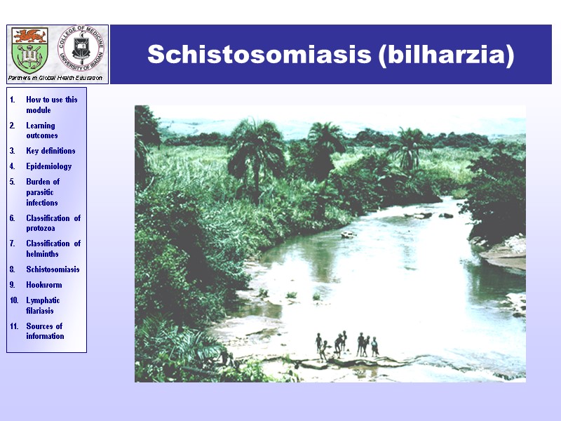 Schistosomiasis (bilharzia)